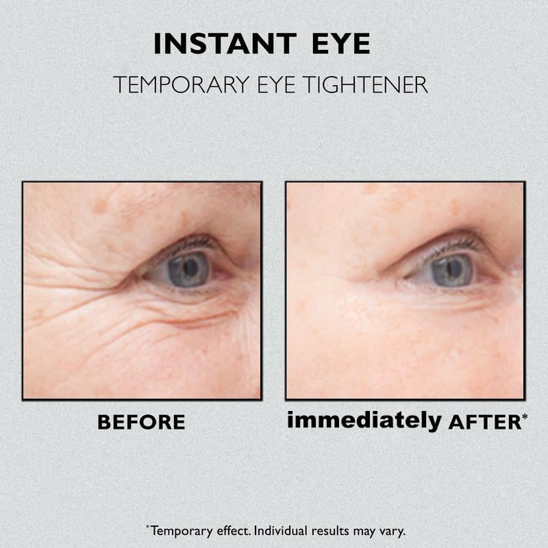 yayaq™-🎁Last Day 49% OFF🎁Instant Eye Temporary Eye Tightener